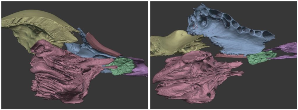 orrüreget alkotó és határoló csontok micro CT felvételének 3D rekonstrukciója